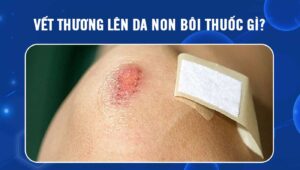 vết thương lên da non bôi thuốc gì