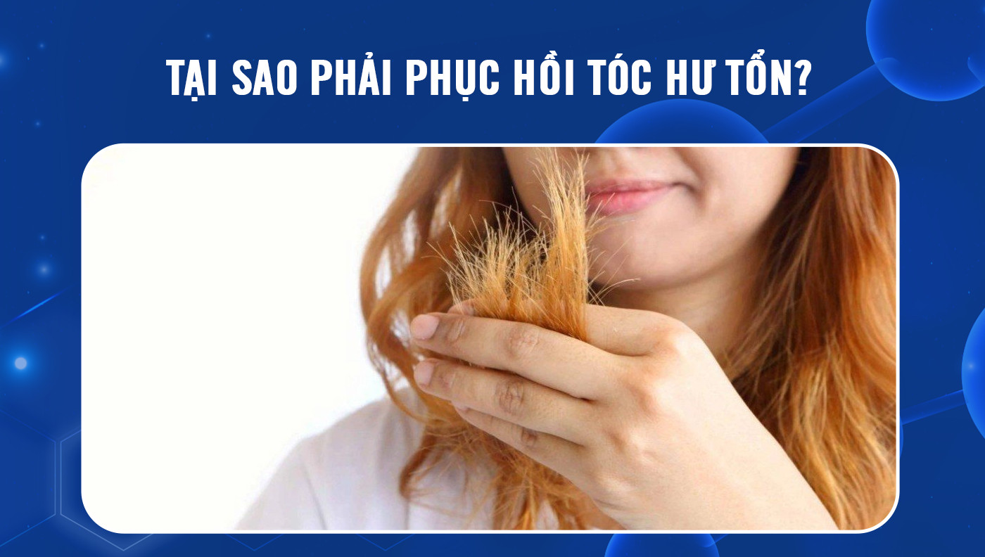30Shine - Khắc phục 4 nỗi khổ về tóc nam giới thường gặp... | Facebook
