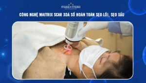 Công nghệ Maitrix Scar xoá sổ hoàn toàn sẹo lồi, sẹo xấu