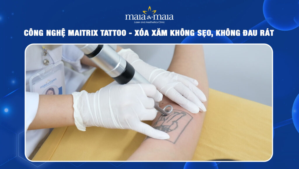 Công nghệ maitrix tattoo thum