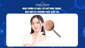 mụn trứng cá bọc thum