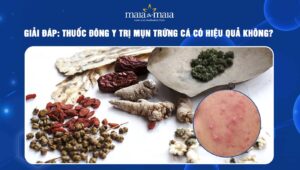 thuốc đông y trị mụn trứng cá