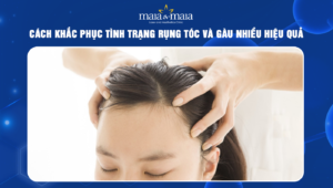 bấm huyệt trị rụng tóc