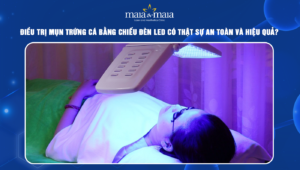 điều trị mụn trứng cá bằng chiếu đèn led