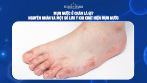 mụn nước ở chân