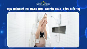 mụn trứng cá khi mang thai
