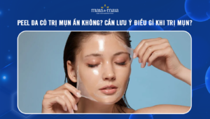 peel da có trị mụn ẩn không
