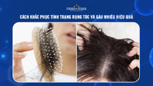 rụng tóc và gàu nhiều