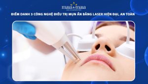 trị mụn ẩn bằng laser