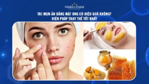 trị mụn ẩn bằng mật ong