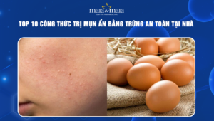 trị mụn ẩn bằng trứng