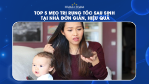 trị rụng tóc sau sinh
