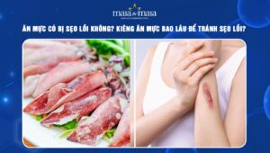 ăn mực có bị sẹo lồi không