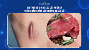 ăn thịt bò có bị sẹo lồi không