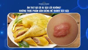 ăn thịt gà có bị sẹo lồi không