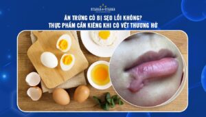 ăn trứng có bị sẹo lồi không