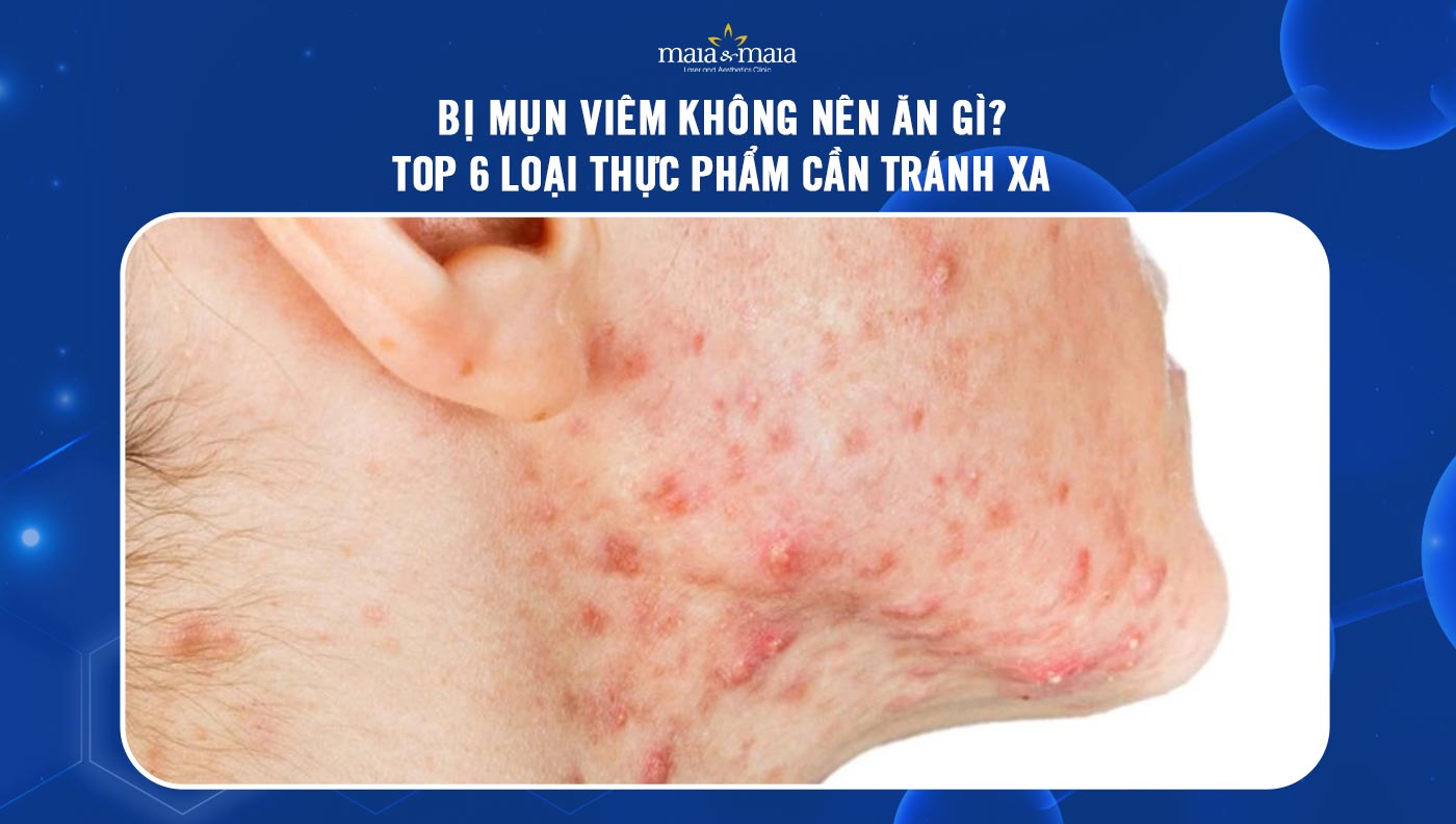 4. Lời Khuyên Chăm Sóc Da Kèm Theo Chế Độ Ăn