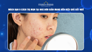 cách trị mụn tại nhà