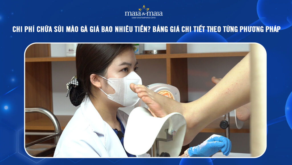 chi phí chữa sùi mào gà