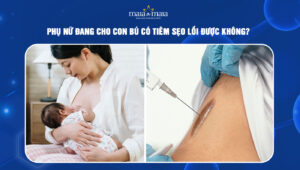 đang cho con bú có tiêm sẹo lồi được không