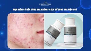 mụn viêm có nên dùng BHA
