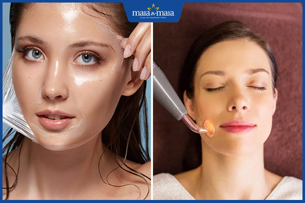 peel da và điện di