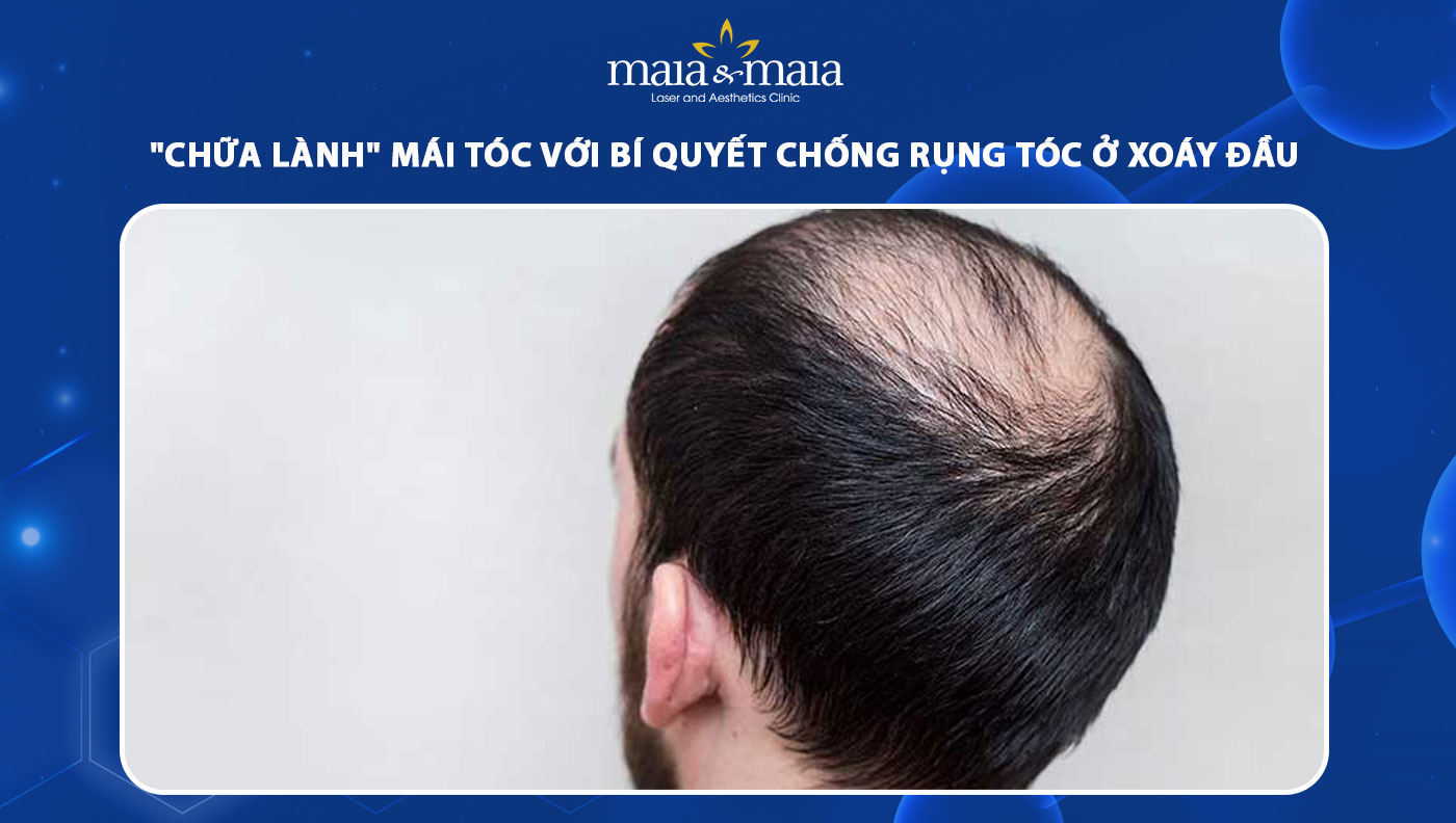 4. Các Phương Pháp Điều Trị Hiện Đại