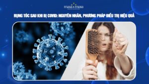Rụng tóc sau khi bị covid