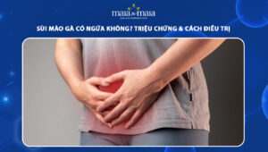 Sùi mào gà có ngứa không