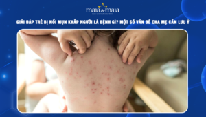 trẻ bị nổi mụn nước khắp người