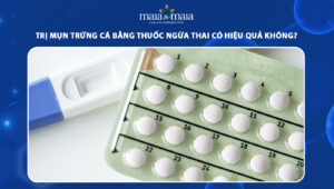 Trị mụn trứng cá bằng thuốc ngừa thai