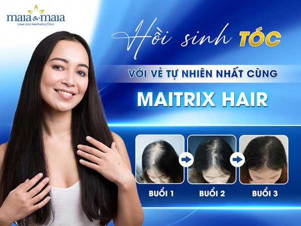 trị rụng tóc bằng công nghệ maitrix hair
