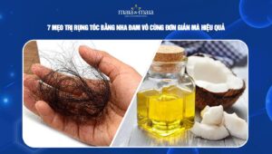 trị rụng tóc bằng dầu dừa