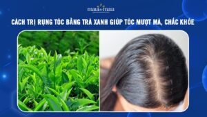 trị rụng tóc bằng trà xanh