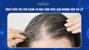 trị tóc rụng và bạc sớm