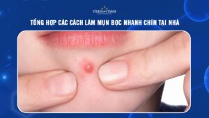 cách làm mụn bọc nhanh chín