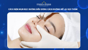 cách nặn mụn bọc không đầu