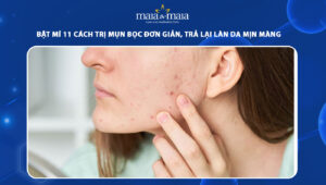 cách trị mụn bọc