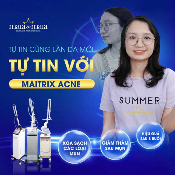 công nghệ maitrix acne
