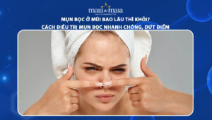 mụn bọc ở mũi bao lâu thì khỏi