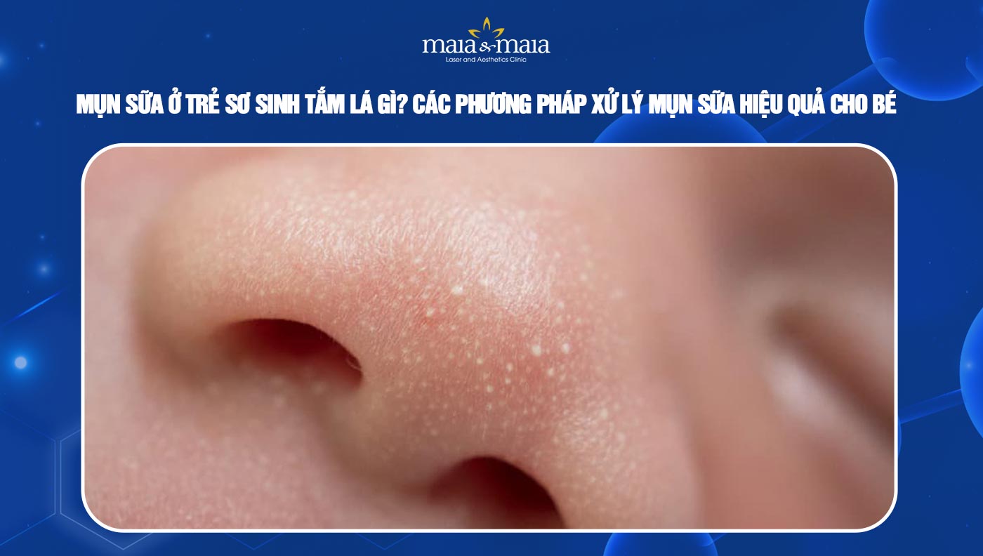 Mụn sữa ở trẻ sơ sinh tắm lá gì? Hướng dẫn cách tắm lá hiệu quả và an toàn