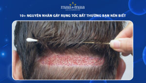 rụng tóc bất thường