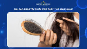 rụng tóc nhiều ở nữ tuổi 17 có sao không
