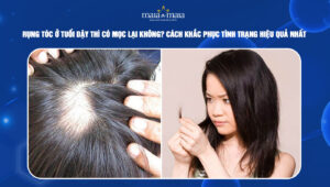 rụng tóc ở tuổi dậy thì có mọc lại không