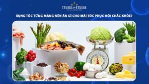rụng tóc từng mảng nên ăn gì