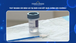 test nhanh sùi mào gà tại nhà