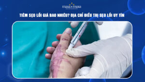 tiêm sẹo lồi giá bao nhiêu