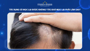 Tóc rụng có mọc lại được không