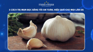 trị mụn bọc bằng tỏi