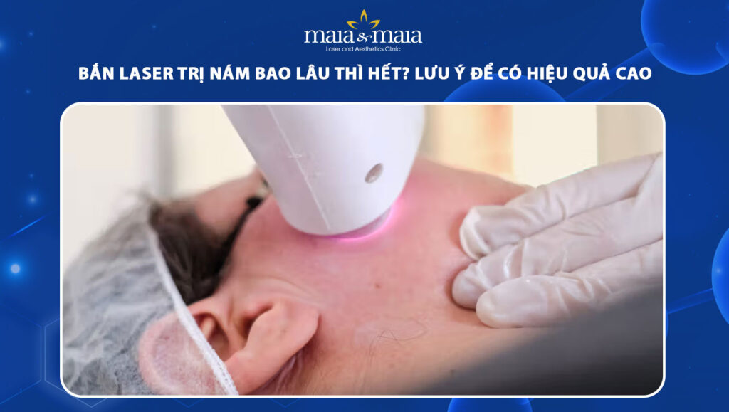 bắn laser trị nám bao lâu thì hết